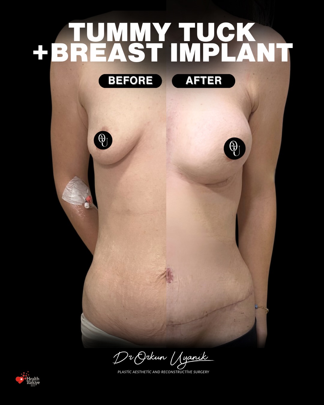 SaveClip.App_619968029_17849472162628507_7740558722473822998_n